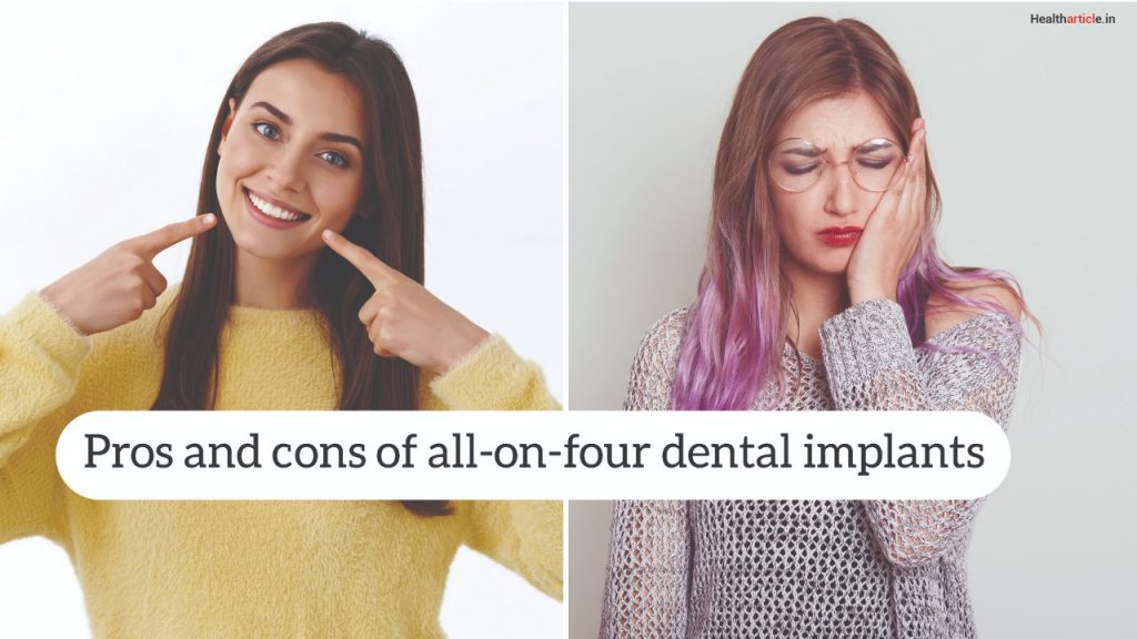 pros and cons of all-on-four dental implants